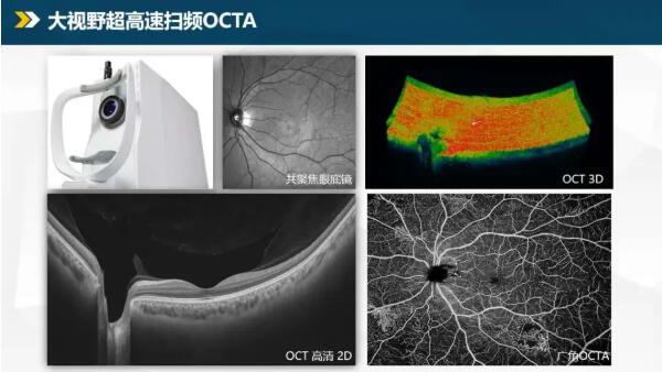 弥补国内医疗影像技术空白，视微影像眼科高端OCT实现量产！(图1)