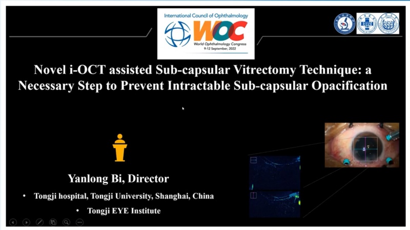 上海市同济医院眼科团队在世界眼科大会(WOC)展示最新诊疗技术及研究成果(图2) 上海市同济医院眼科团队在世界眼科大会(WOC)展示最新诊疗技术及研究成果(图2)